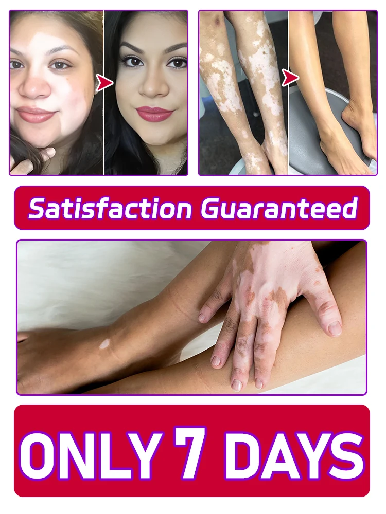 

Just 7 days brings a difference