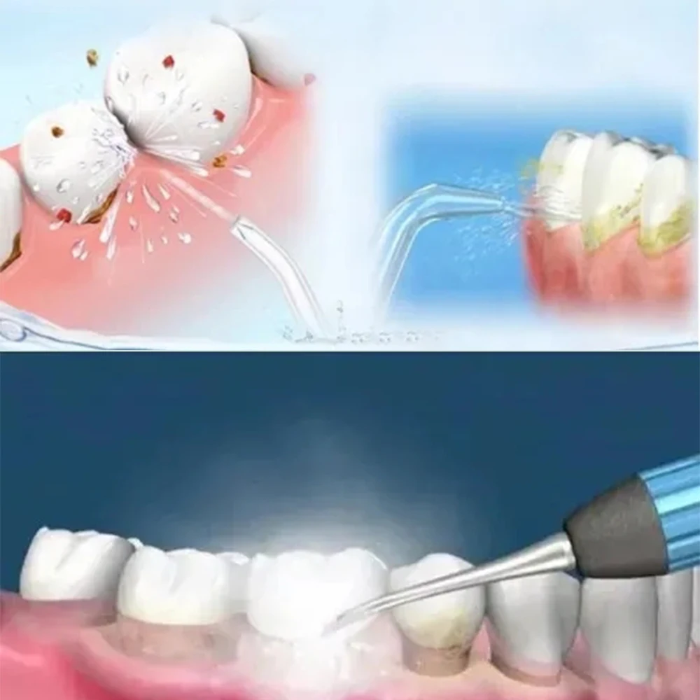 Dental Sandblasting Powder Micron Aluminum Oxide Powder Polishing Cleaning Teeth for Blaster Air Flow Jet 90/50/30um Tools