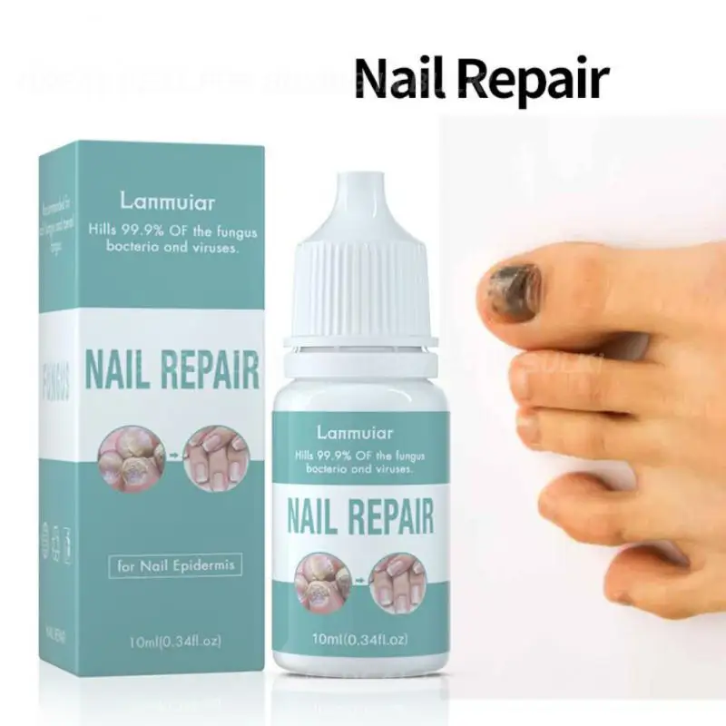 15ml Fungal Nail Repair Serum Foot Toe Nail Fungus Atreatment Nails Gel Anti Paronychia Onychomycosis Nails Care TSLM2