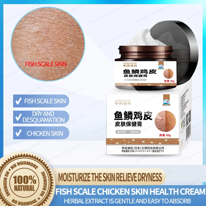 

Крем для ухода за кожей куриной кожи рыбьей чешуи Крем для ухода за сухой кожей Мягко увлажняет кожу