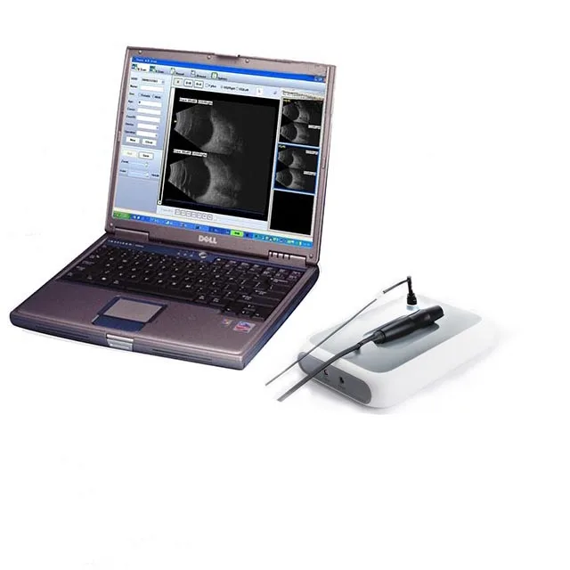 SW-2100 China Ophth…