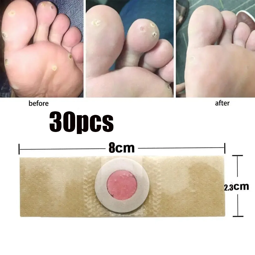 30PCS Parches de espuma indoloros para callos, verrugas y durezas en los pies, para el cuidado de los talones y alivio del dolor en los zapatos