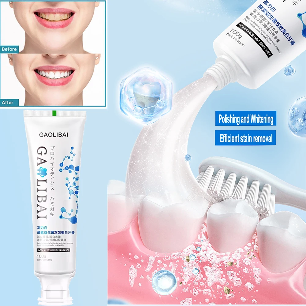 Teeth Whitening Toothpaste Dental Calculus Removal Plaque Stains Fresh Bad Breath Oral Cleaning Prevent Periodontitis Fluoride