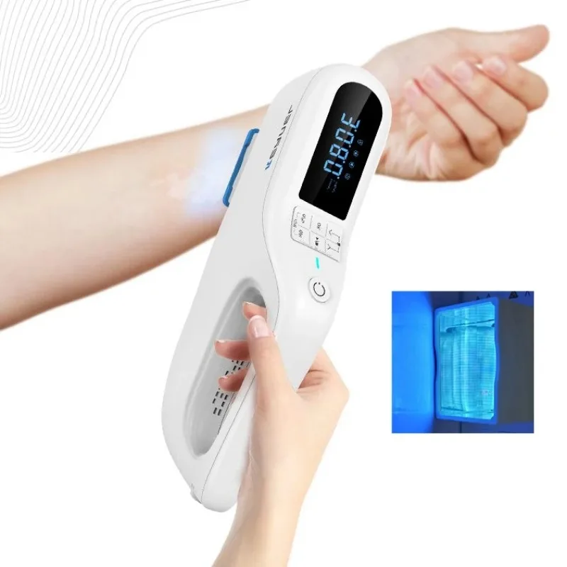 

New portable 308 excimer KN-5000F targeted treatment 308nm phototherapy for psoriasis vitiligo eczema