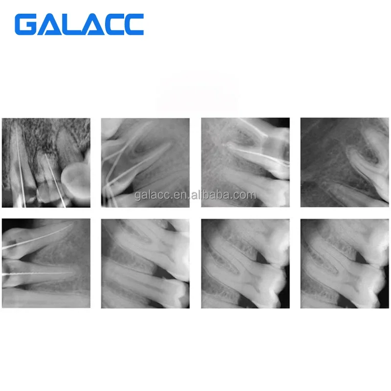 Цифровая внутриротовая рентгеновская система клиники Рентгеновский датчик Rvg / рентгеновский цифровой датчик для клиники