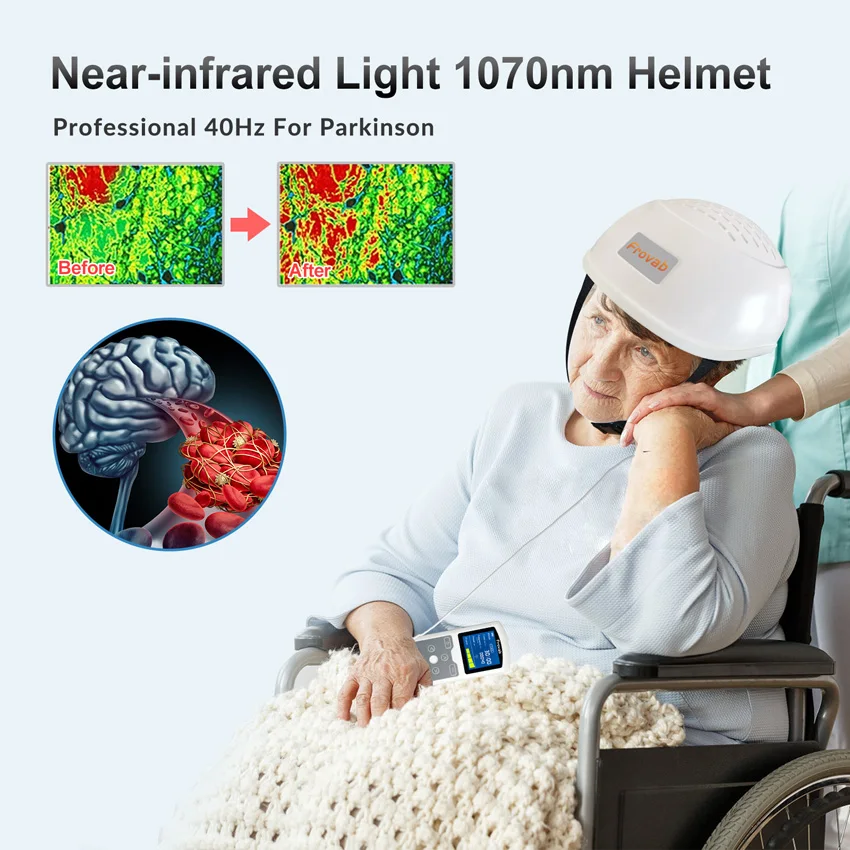 1070nm Infrared Light Therapy Helmet Photobiomodulation Brain RTMS Device for Parkinson Alzheimer Stroke Depression 280 Diodes