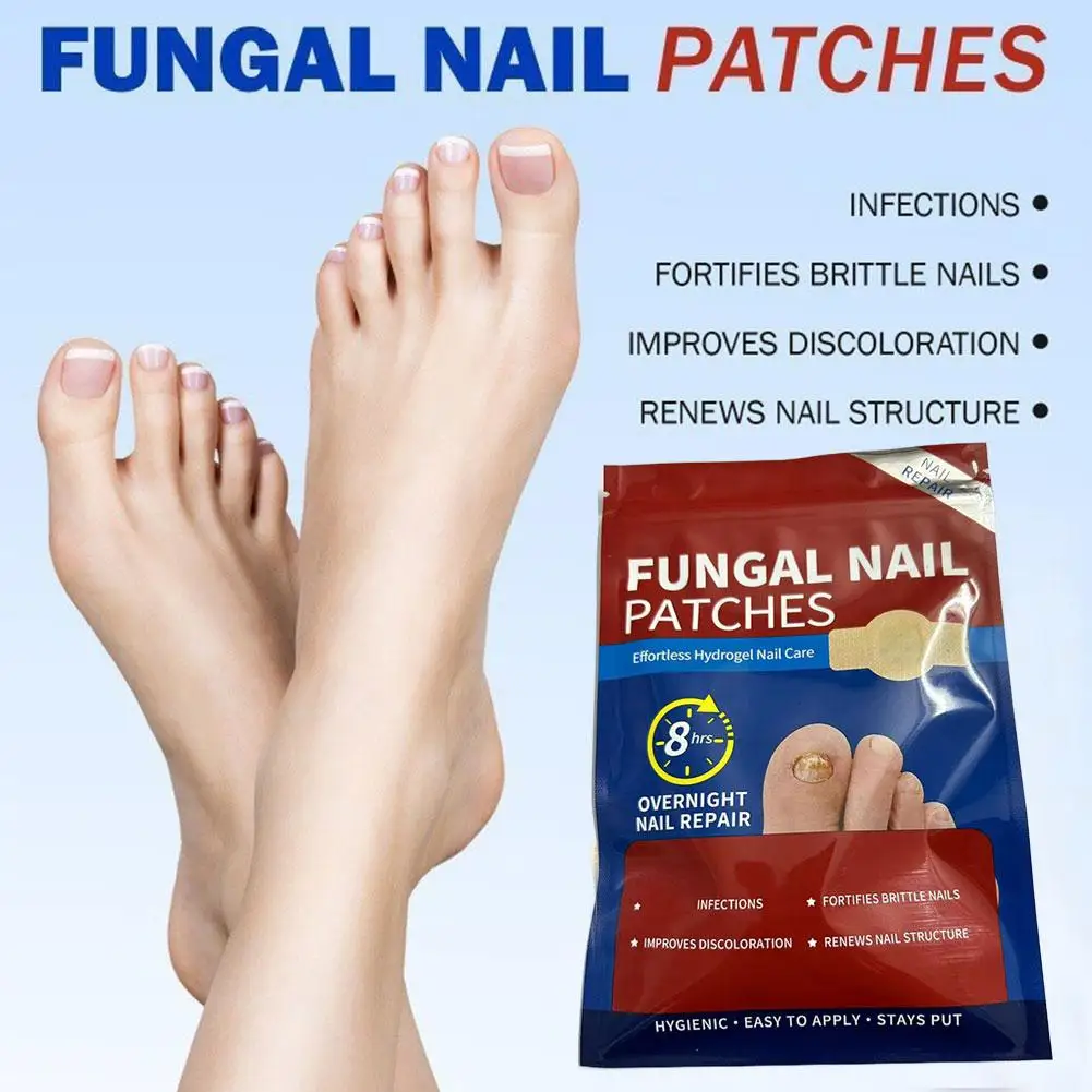 

21 шт., пластырь с грибком на ногах, водостойкие патчи для ремонта ногтей, наклейка для коррекции вросших ногтей, обесцвеченные поврежденные ногти, инструмент для ухода за ногами
