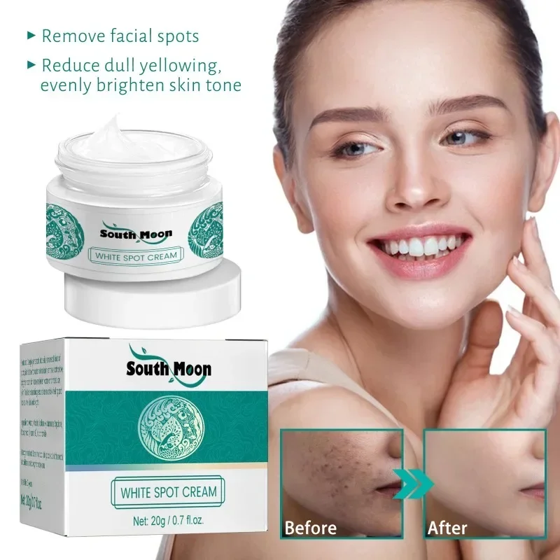 Effective Remove Spot Whitening Face Cream Fade Dark Spot fine lines firming Skin care Freckle  Moisturize Brighten Beauty Care