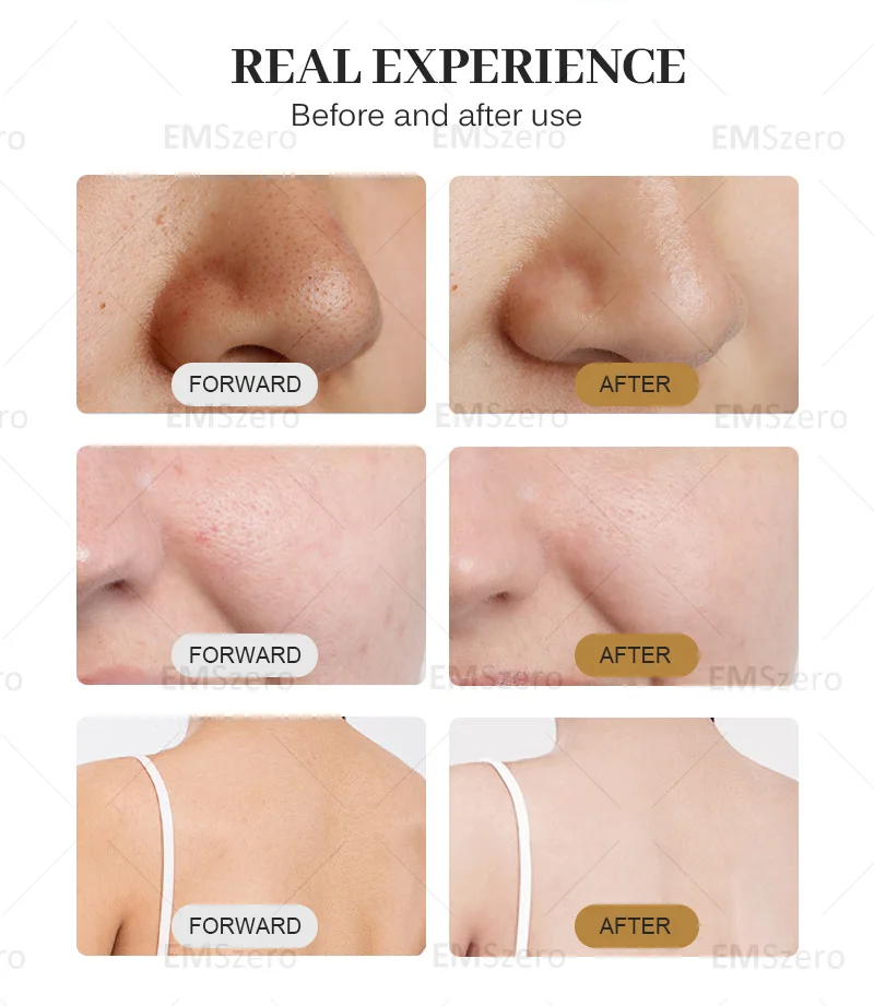 Portable Hydra Water Skin Care Peeling Face Tightening Oxygen Hydro Machine Dermabrasion Peel Facial Deep Cleansing For Spa