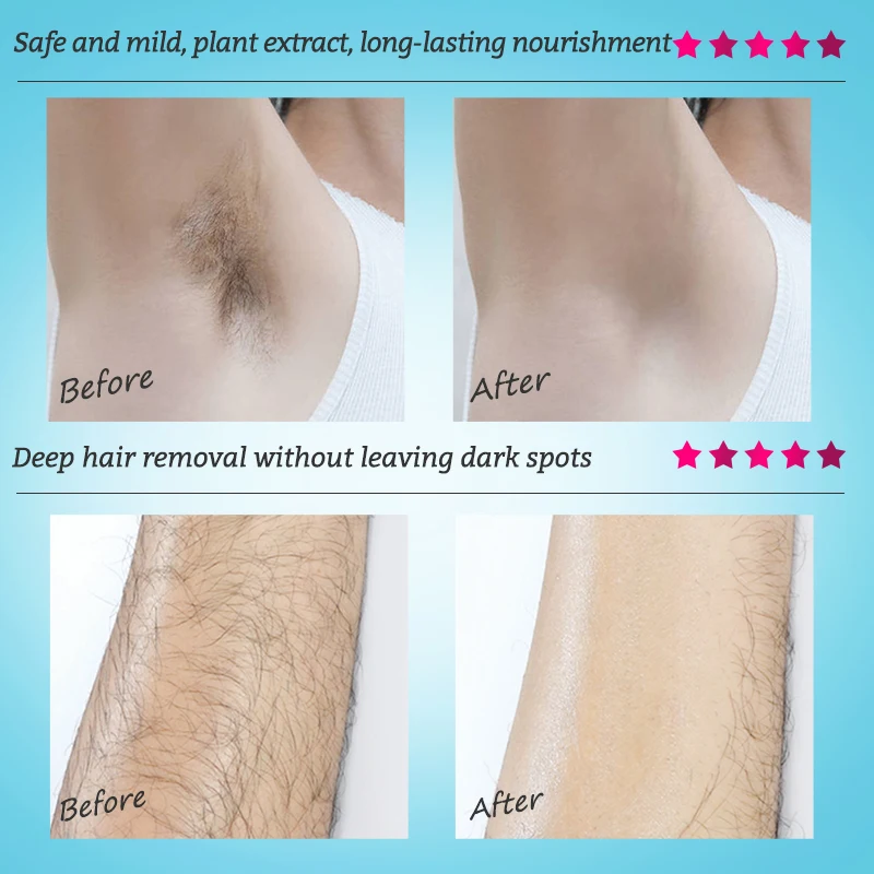 Mango Depilatory Cream Body Painless Effective Hair Removal Cream for Men and Women Whitening Hand Leg Armpit Hair Loss Product