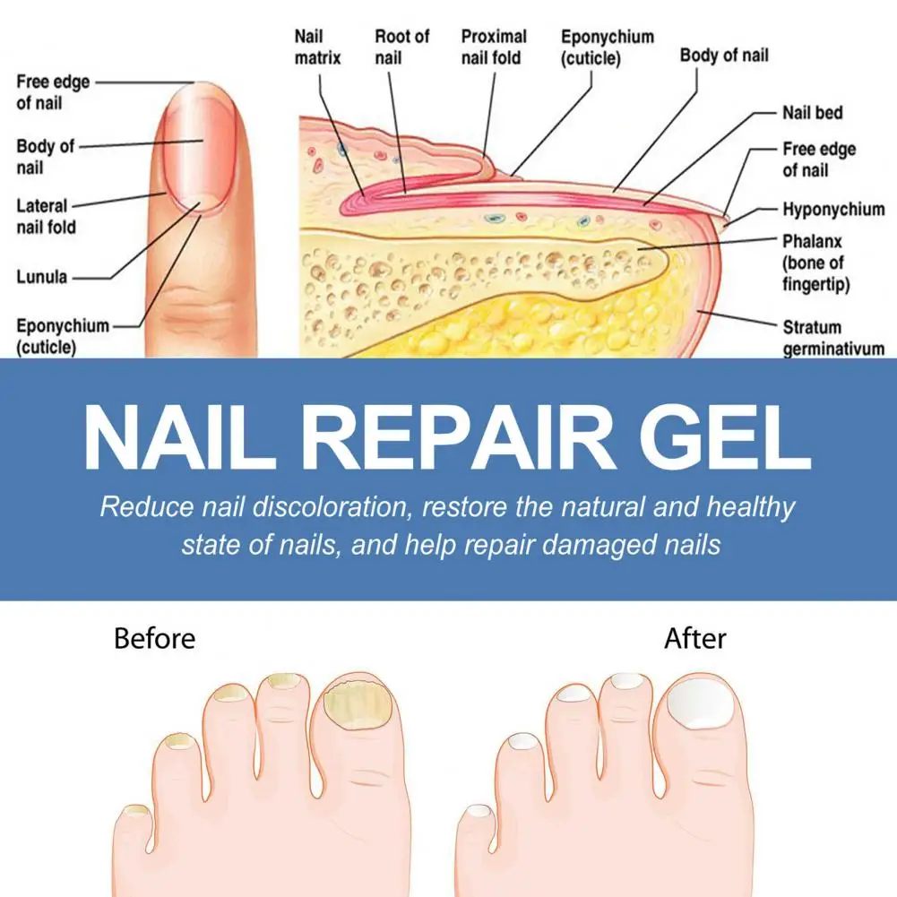 Nail Repair Gel Effective Nail Treatment Gel for Strengthening Repairing Beautifying Nails Long Lasting for Manicure