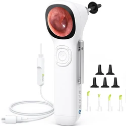 SA160 Digital Otoscope IPS Screen HD Smart Video Otoscope with Light, Ear Scope Otoscope with Camera Ear Wax Removal Camera