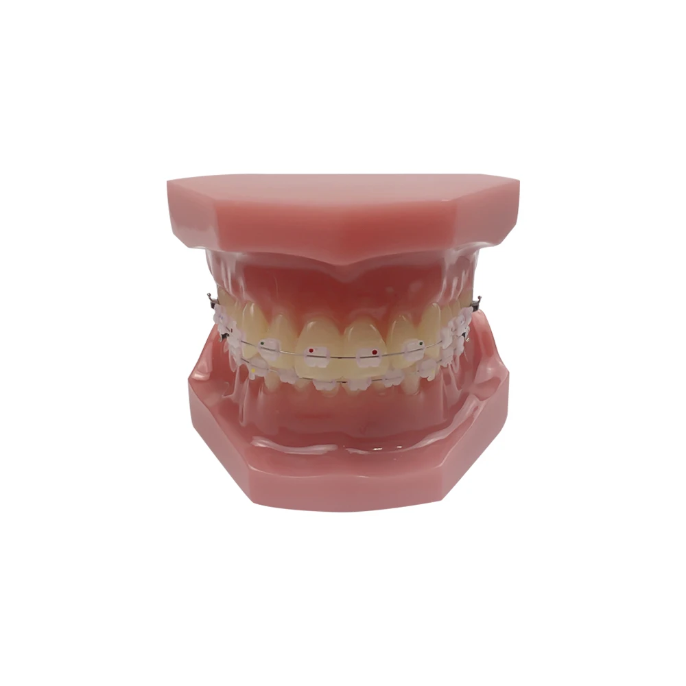 Model nauczania ortodontycznego Model ustny pół ceramiczny pół wspornik metalowy do narzędzia komunikacji lekarz-pacjent dentysty