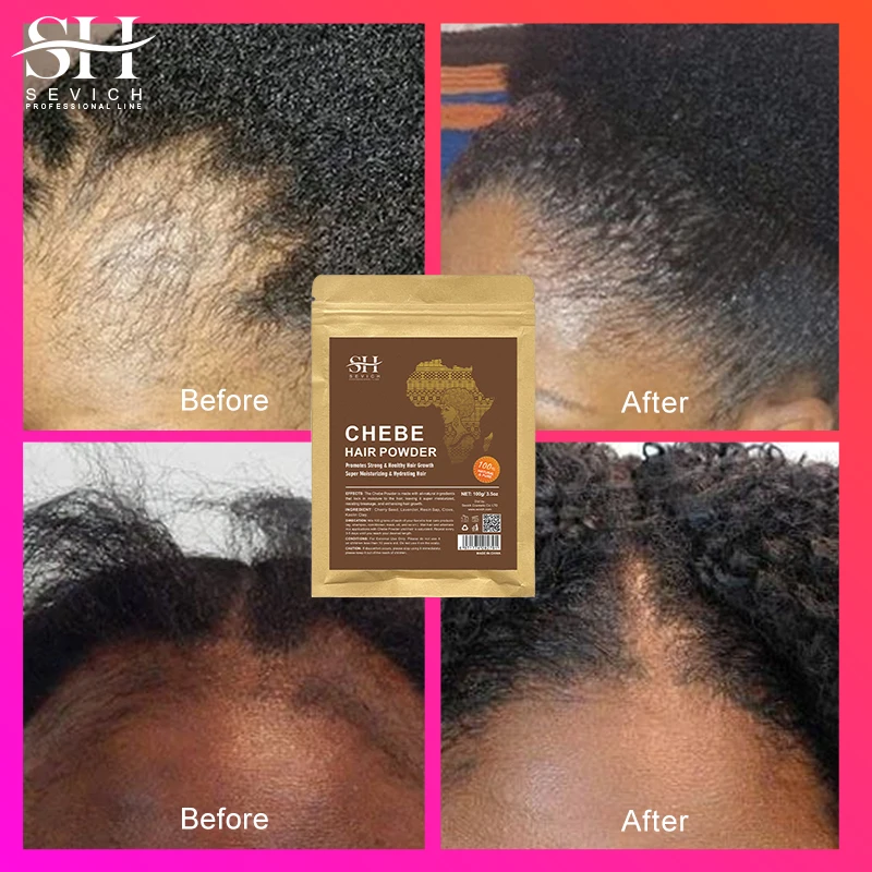 Sevich 100% Chebe Powder Effective Growthing Hair Improves Hair Density Nourishes Follicles Fast Regrowth Hair Product 100g