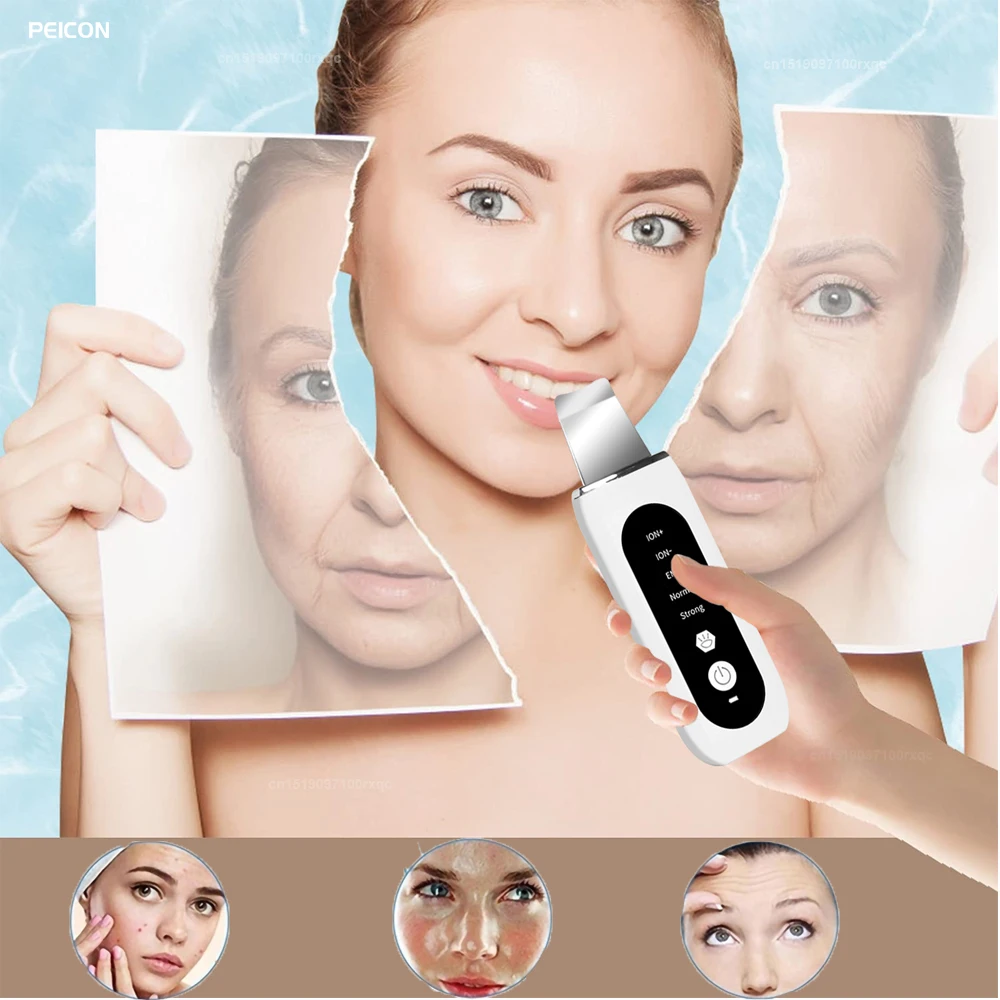 Ultrasonic Skin Scrubber Deep Face Cleaning Peeling Blackhead Remover Ultrasonic Ion Ance Pore Cleaner Facial Shovel Cleanser