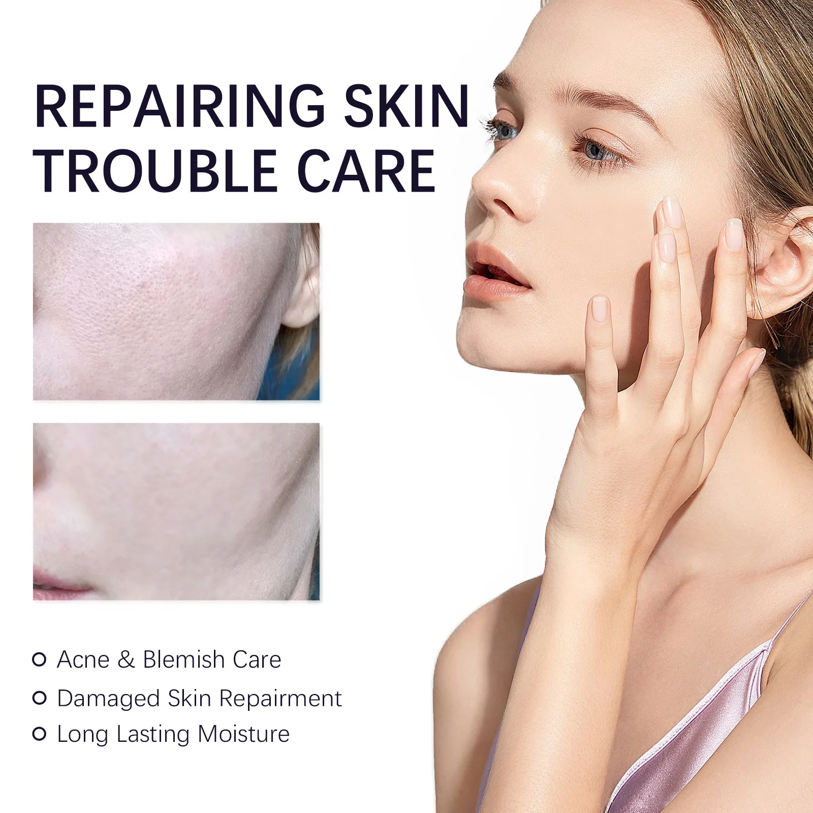 Repairing Skin Trouble Care Sleeping Cream Facial Care, Damaged Skin Repairment and Long Moisturizing Effect, 50g