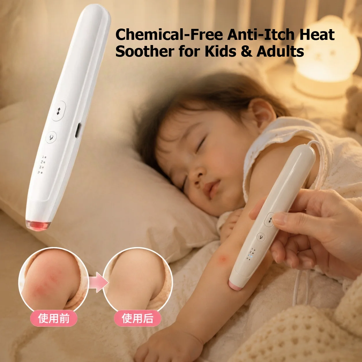 Mosquito Bite Healer Pen Portable Heat Anti‑Itch Soother Chemical Free Insect Bug Bite Relief Pen for Kids Adults OutdoorCamping