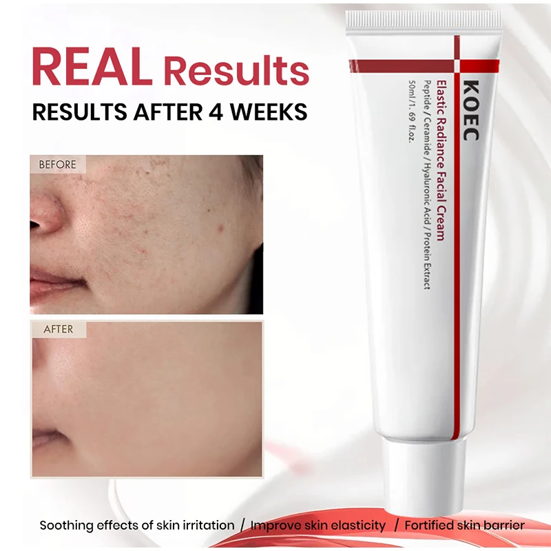 

Centella Asiatica Moisturizing Cream Niacinamide Deep Moisturize Reduces Wrinkle Brightens Skin Tone Brand Best-sell Moisturizer