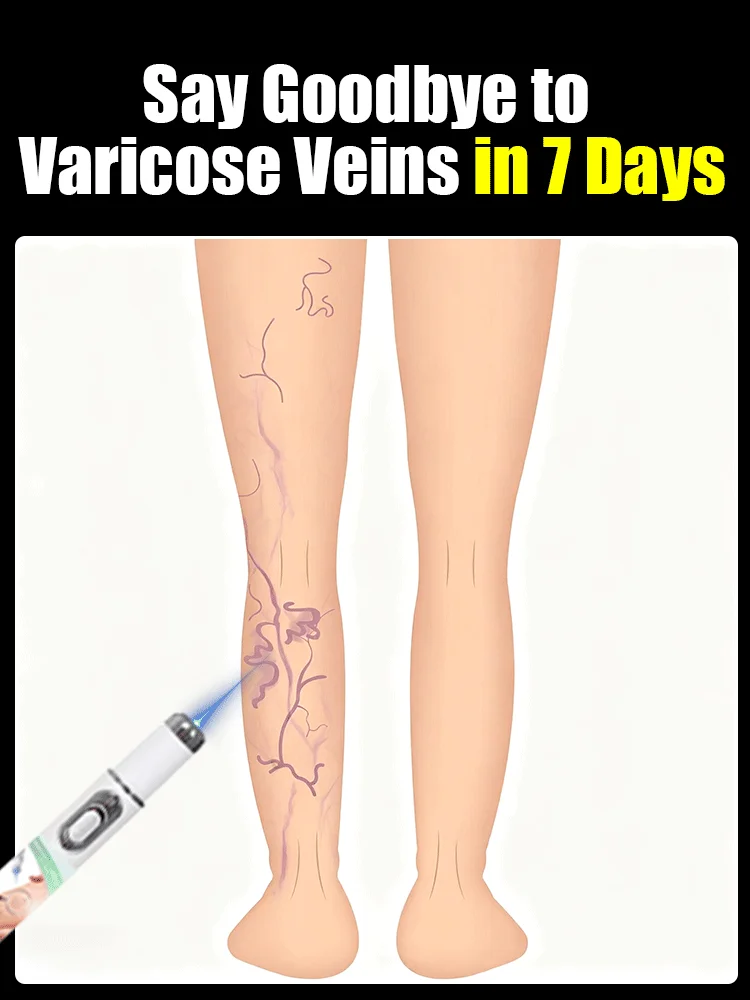 

Hot 2 generation laser tool, safe and pain-free for varicose veins.