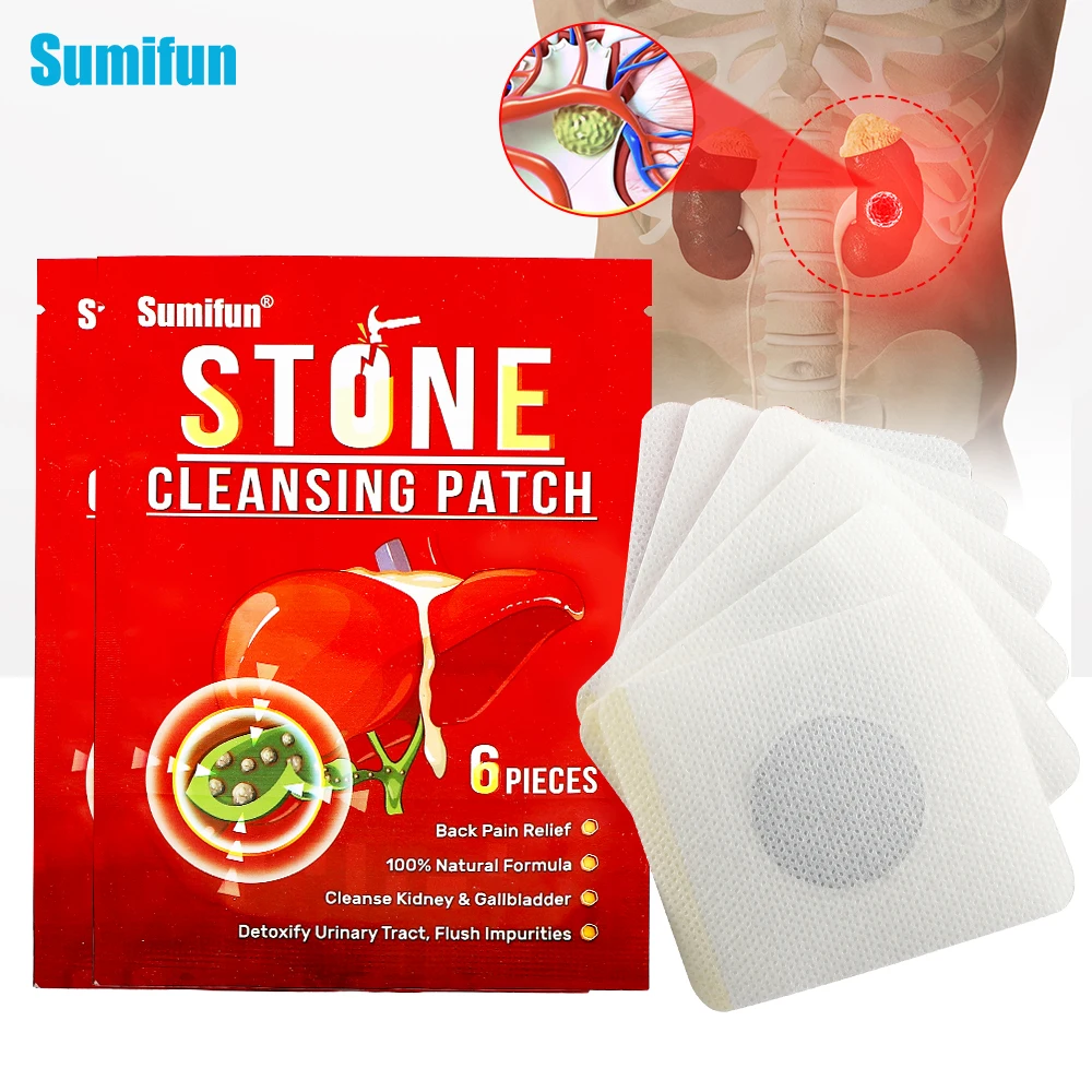 

6Pcs Renal Calculus Removal Plaster Treat Kidney Stones Gallstones Chinesse Medicinal Patch Urolithiasis Pain Relief Sticker