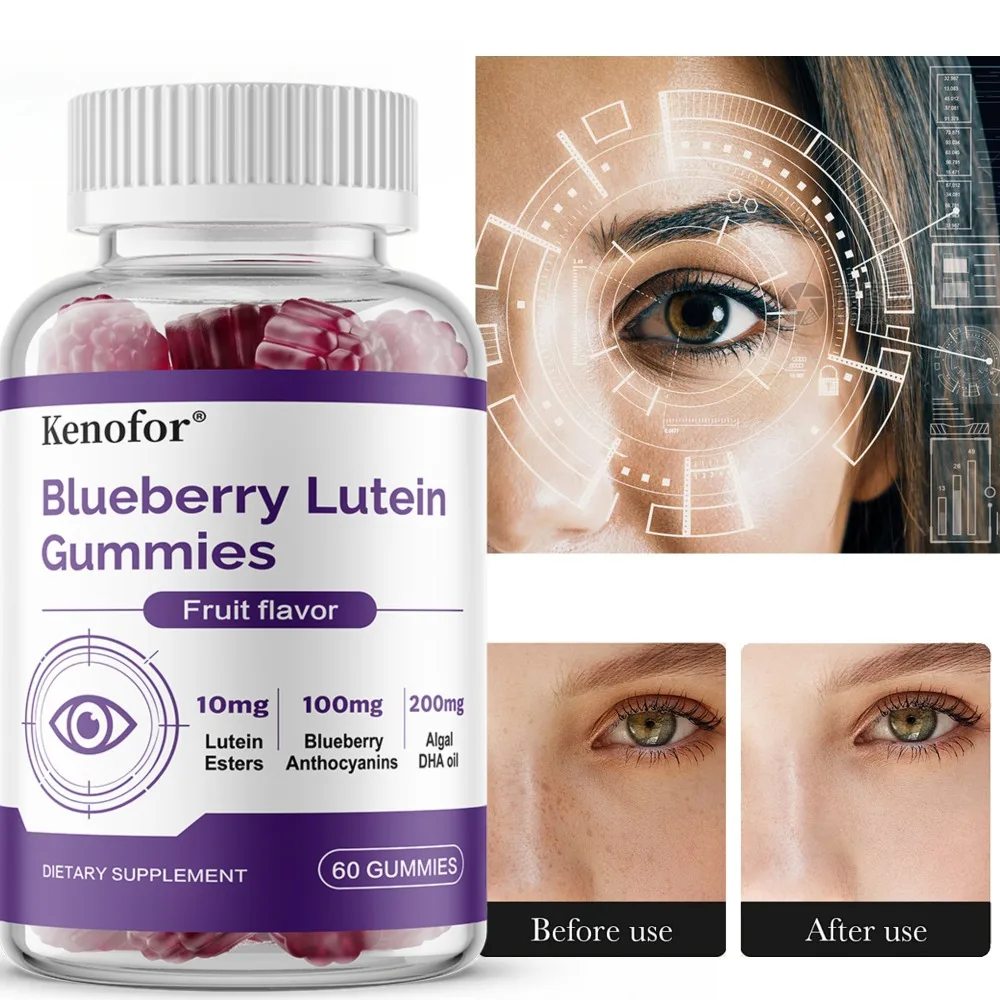 Vision Support Gummies - with Lutein, Blueberry - Helps Maintain Healthy Vision, Relieve Eye Fatigue, Dry Eyes Supplements