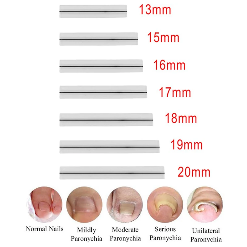 Ingegroeide teennagel Correctie Tool Rechttrekken Clip Brace Ingegroeide teen Nagelbehandeling Elastische patch Sticker Pedicure Tool