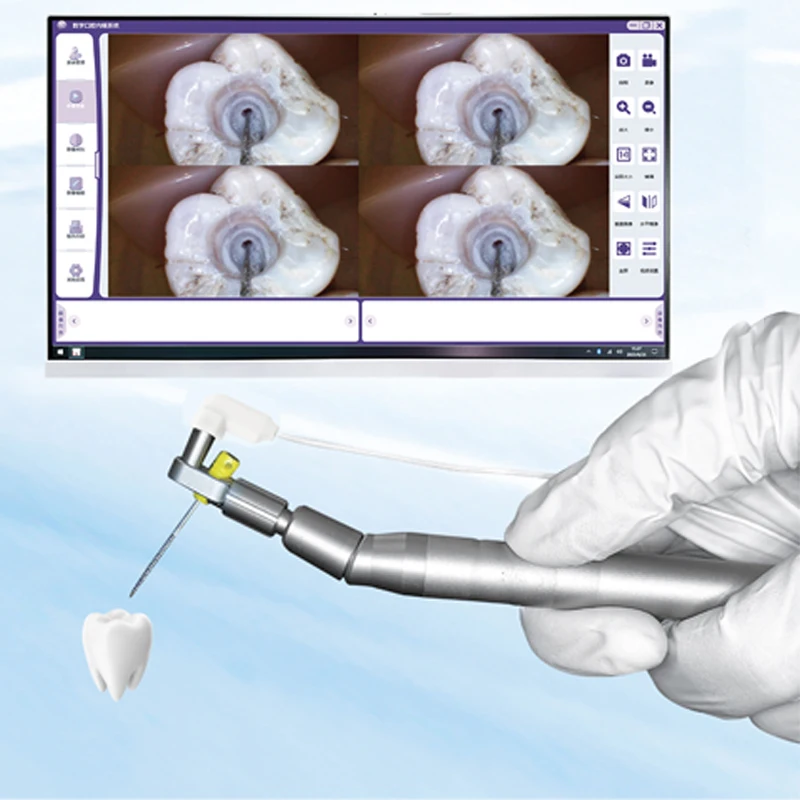 New Dental Intra Oral Camera Wifi Screen Visual Root Canal Removal Endo Motor Treatment Dental Micro Camera Intraoral Endoscope