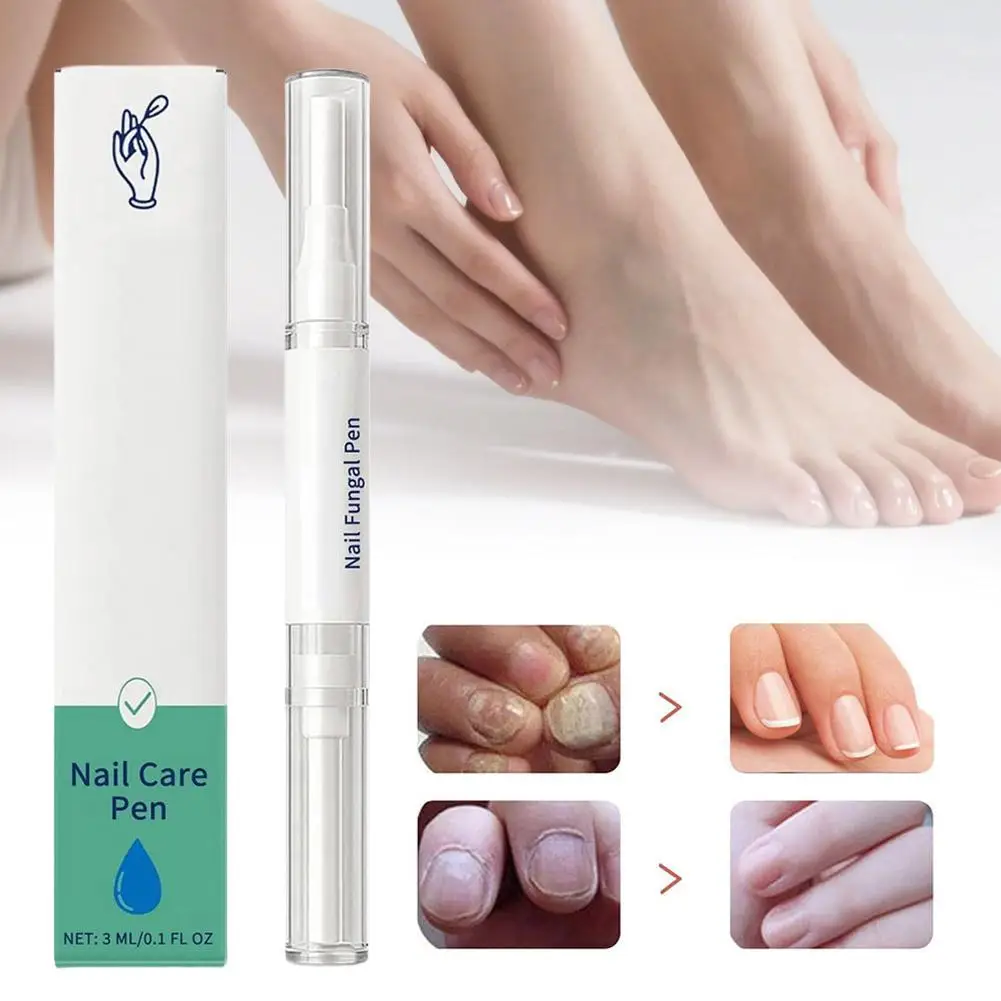 

Ручка для ухода за ногтями, ручка для лечения грибка, увлажнение, укрепление поврежденных ногтей для рук, ног, ремонт ногтей, лечение грибка ногтей, уход Q0R7