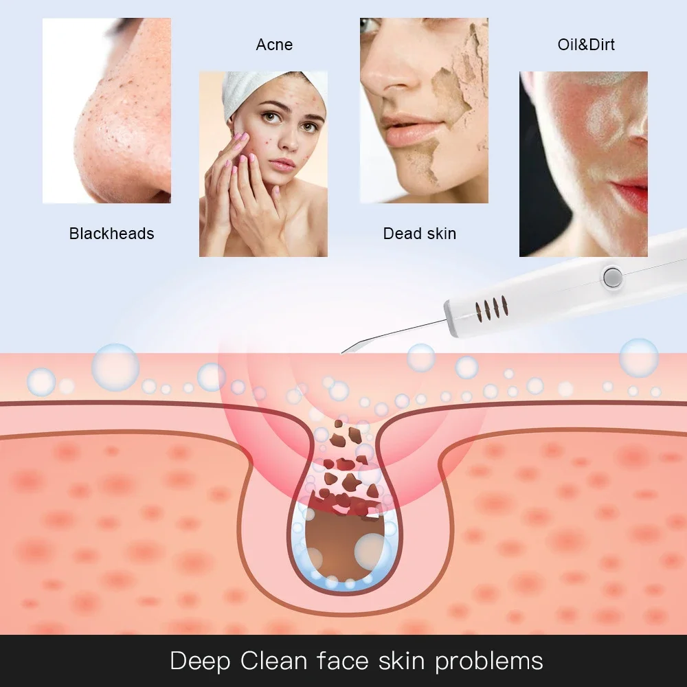 Potente scrubber per la pulizia del viso ad ultrasuoni per la pulizia profonda dei punti neri Rimozione delle macchie dell'acne Strumento di bellezza utilizzato per la casa Cura della pelle