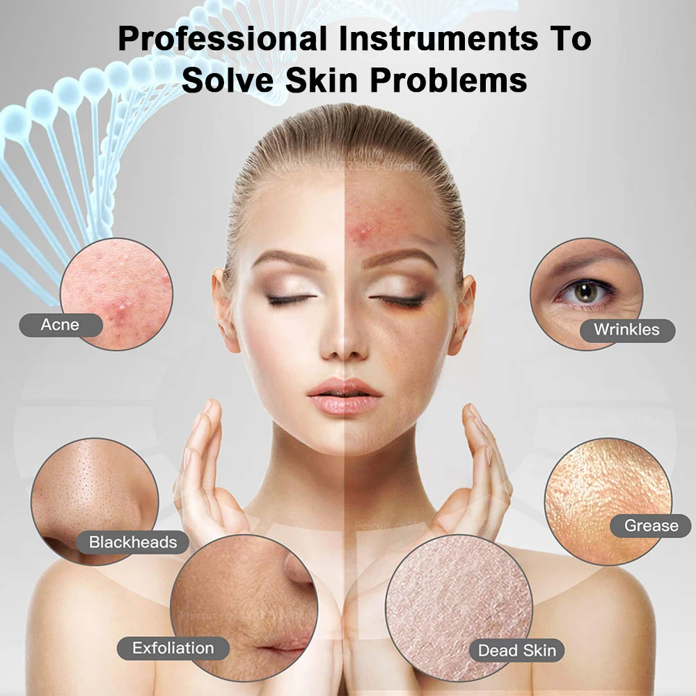 Ultrasonic Skin Scrubber Peeling Blackhead Remover Ion Acne Pore Cleaner Deep Face Cleaning Ultrasonic Facial Shovel Scrubber
