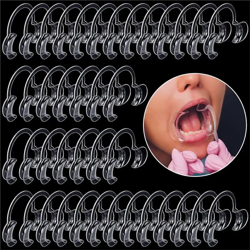 【Electronic-Accessories】C-Shaped Flare,Mouth Opener For Teeth Whitening, 100 Pcs C-Shape For Teeth Whitening Cheek Retractor, De