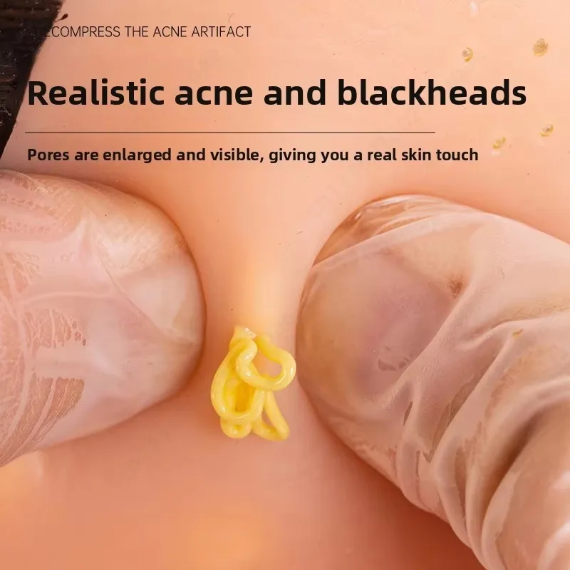 Realistic Silicone Head Model Simulate Pimple Blackhead Burst Stress Relief Fidget Toy Suitable For Ages 14 And Up