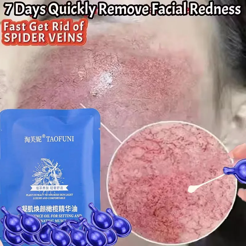 

Fast Repair Facial Redness Essential oil Soothing Red Blood Rosacea Improve Sensitive Skin Dryness Moisturizing Korean Cosmetics