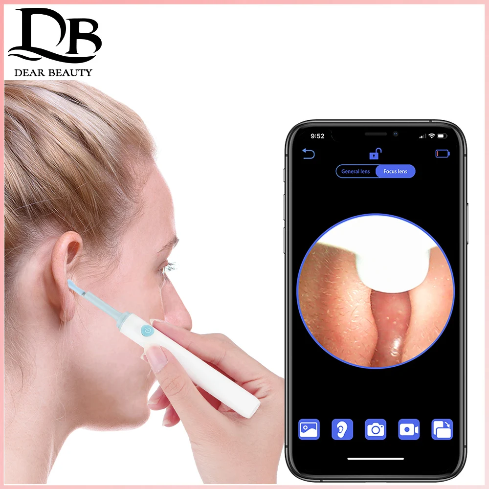 

Wholesale Ear Wax Wireless Intelligent Visual Pick Massage Cleaning Tool 3.9mm Luminous Endoscopy High-definition Otoscope Spoon