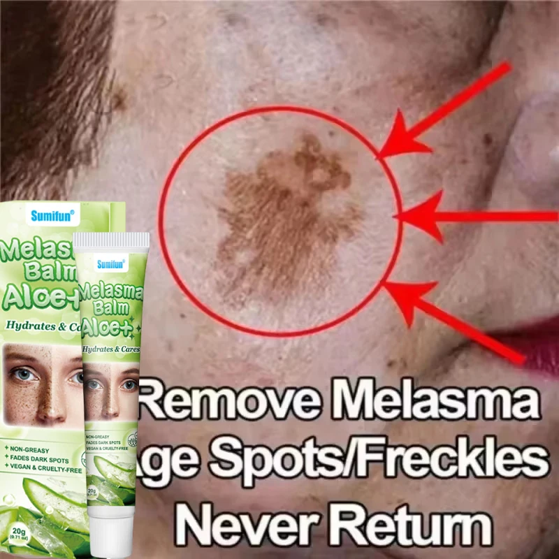 

Powerful Spot-removing Whiten Cream Brighten Skin Fast Eliminates Melanin Pigmentation Melasma Dark Spots Korean Skin Care