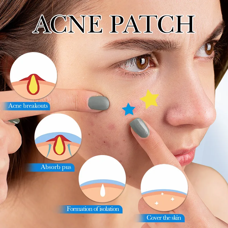 75Patches/Box Star Round Acne Patch Colorful Invisible Acne Removal Skin Care Stickers Concealer Face Spot Beauty Makeup Tools