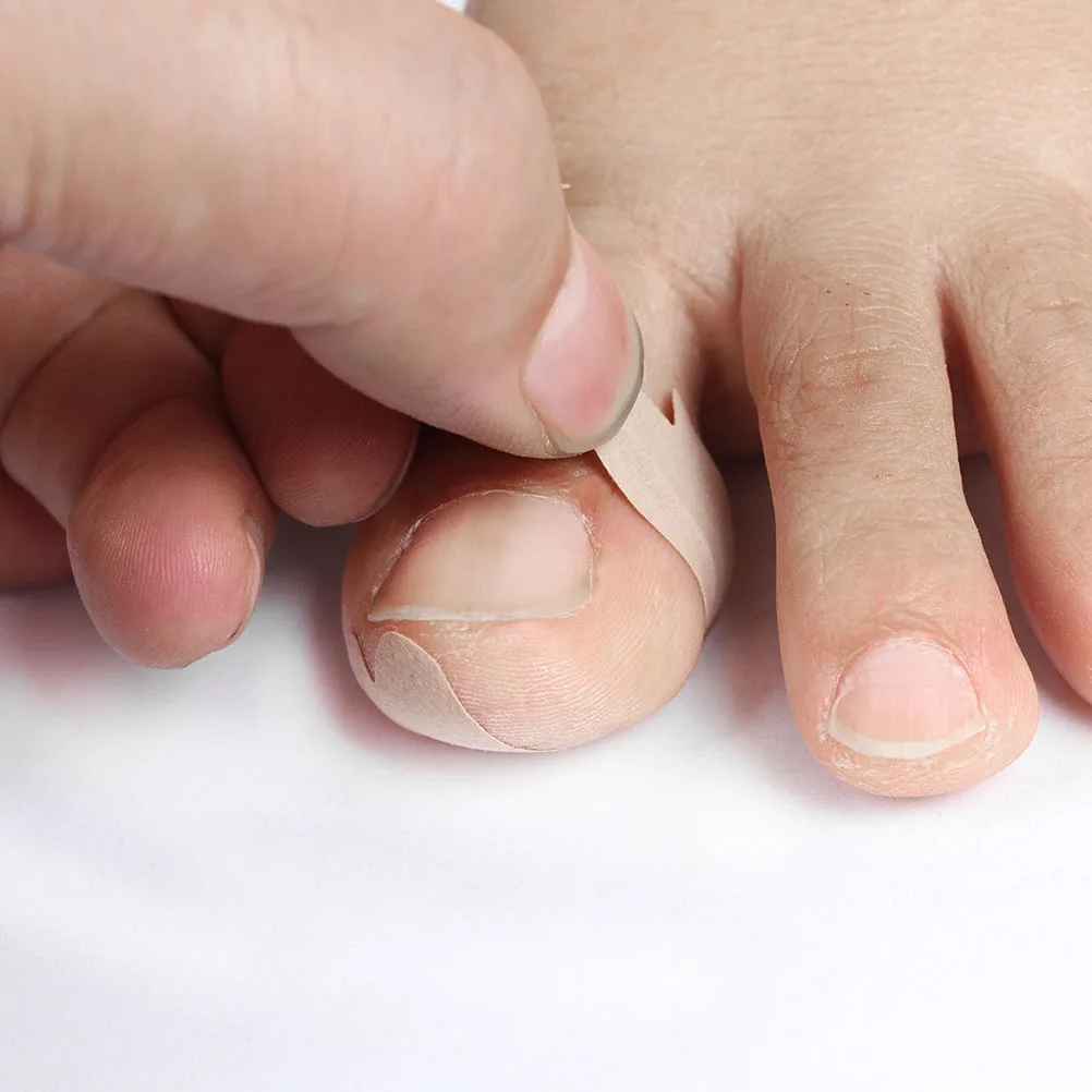 

24pcs Corrector Patches Waterproof Self-Adhesive Ingrown Toenail Treatment Tool For Home Use Toenail Healing Tape Patch Recover