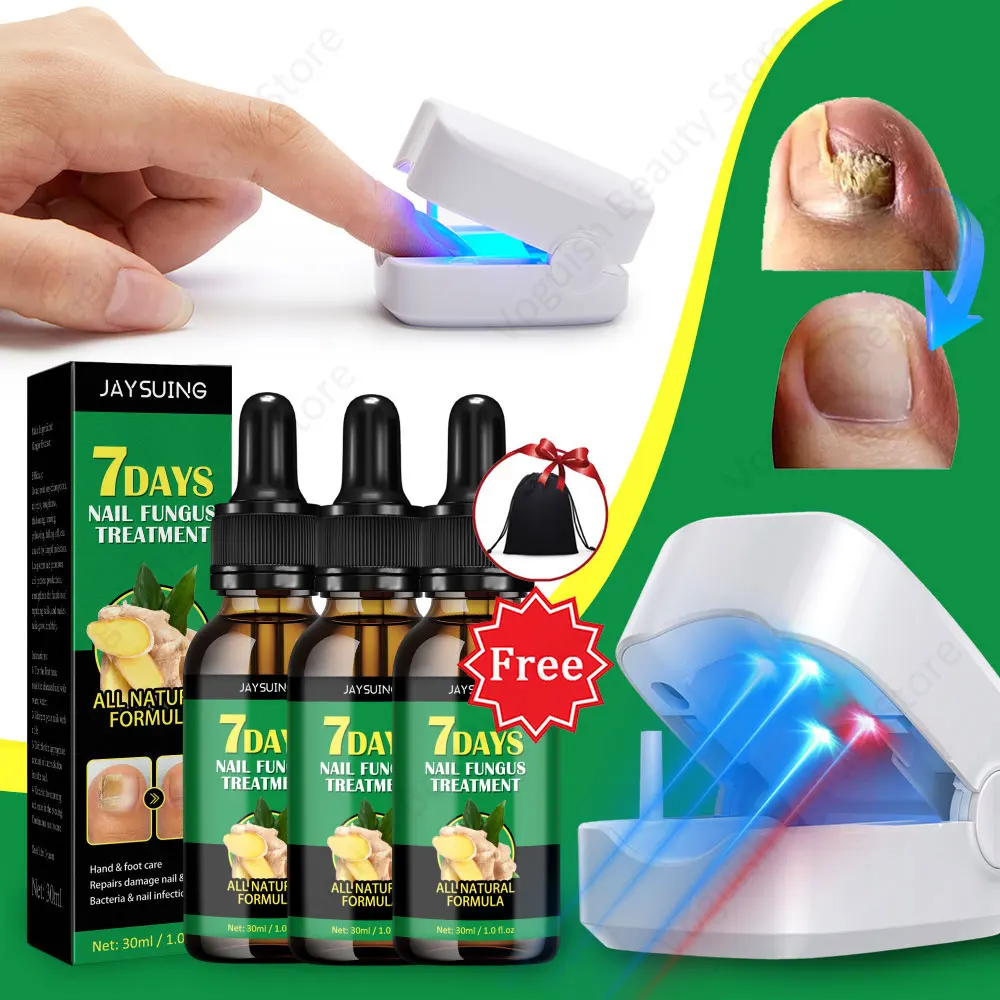 Repair Nail Fungus Laser Treatment Device Nail Fungal Essential Oil Toenail Fingernail Onychomycosis  Serum Toe Cure Effectively