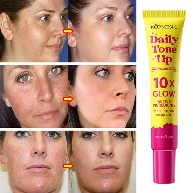 Spot-Removing Whiten Cream Brighten Skin Fast Eliminates Melanin Pigmentation Melasma Dark Spots Deeply Moisturizing Beauty Gel