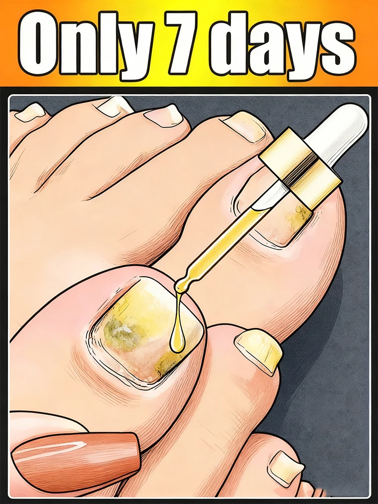 محلول أظافر تي إي تري، العناية اليومية، 10 مل