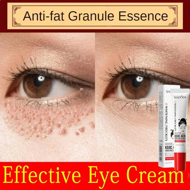 Fett Granulat Entferner Augen creme Anti-Schwellungen entzündung hemmende feste Creme reduzieren dunkle Kreise verblassen feine Linien Reparatur Barriere