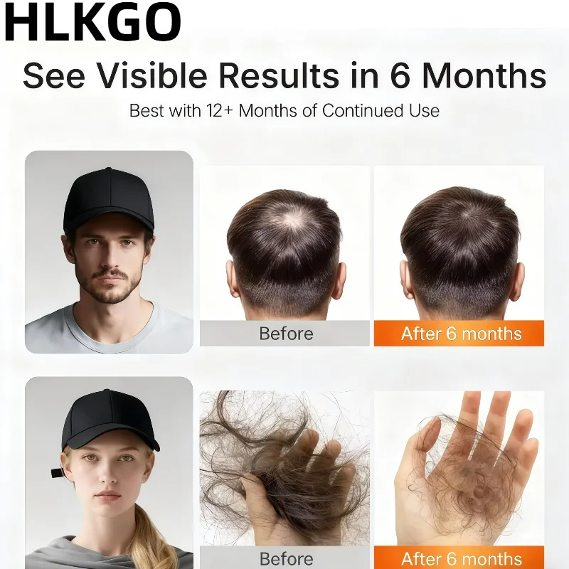 

96 Diodes Hair Growth Laser Helmet, 650nm Wavelength USB Rechargeable for Regrowth and Loss Treatment