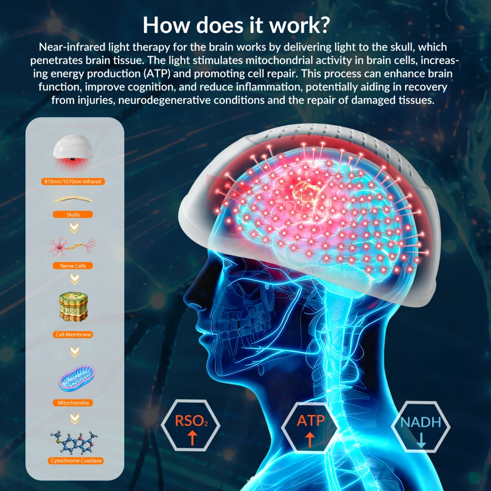 GOVW Upgrade 24W PBM Near Infrared Light Therapy 810nm Photobiomodulation Helmet Brain Physiotherapy Stroke Parkinson Alzheimer