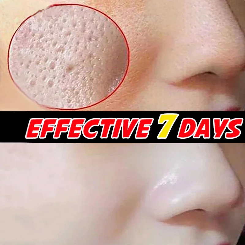 

Korean Pore Shrinking Serum Anti-Wrinkle Nourish Dry Skin Smoothing Rejuvenation Skin Brightening Whitening Facial Moisturizer