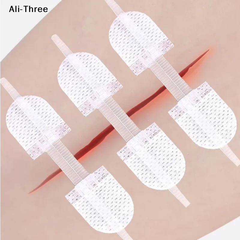 

1 шт., ремешок на молнии, пластыри для закрытия ран, дышащие бесшовные эластичные шовные повязки на молнии для ухода за ранами, брекеты, опоры