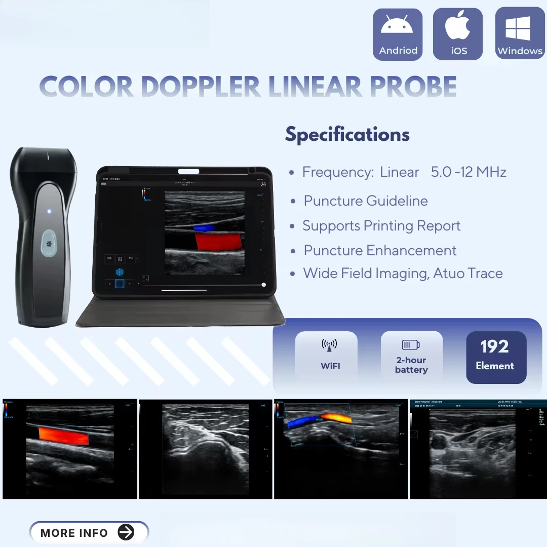 Applicable to Portable Wireless Ultrasound Probe Scanner Linear 3 in 1 High-Precision Imaging Multi-System IOS/Android/Windows S