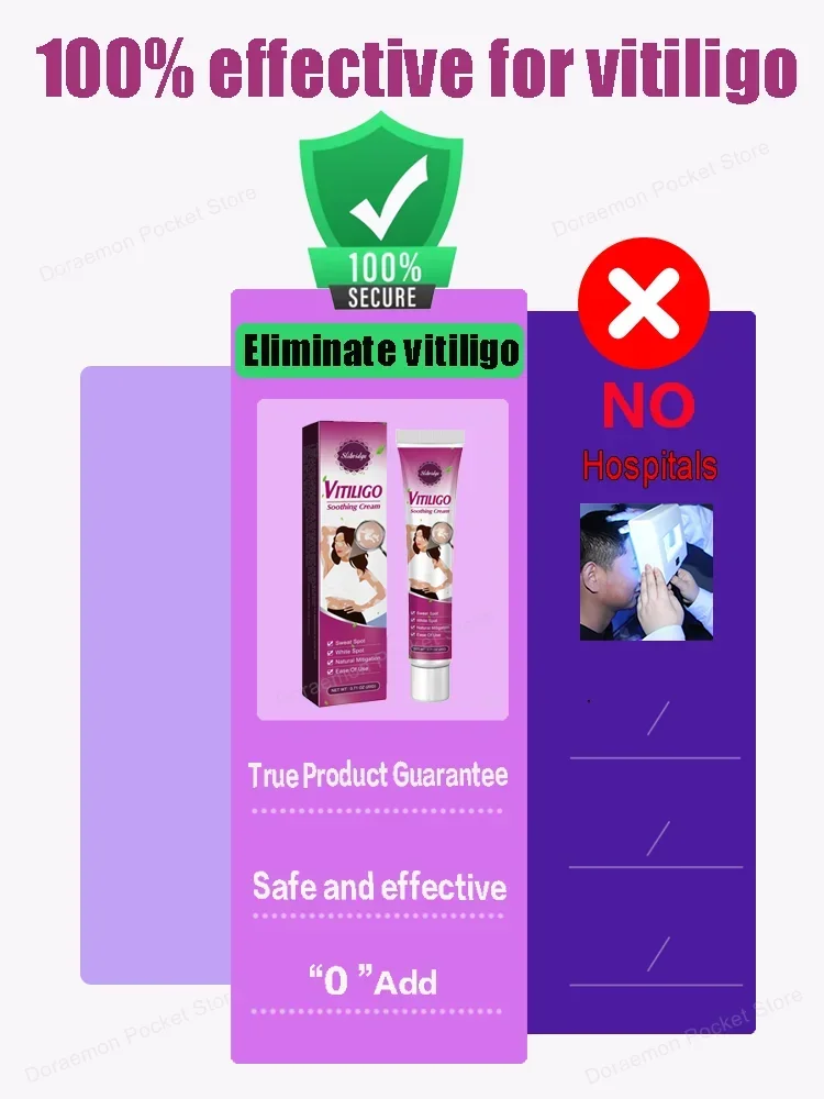 Vitiligo Ointment Effectively Improvement Skin Eliminate White Spot