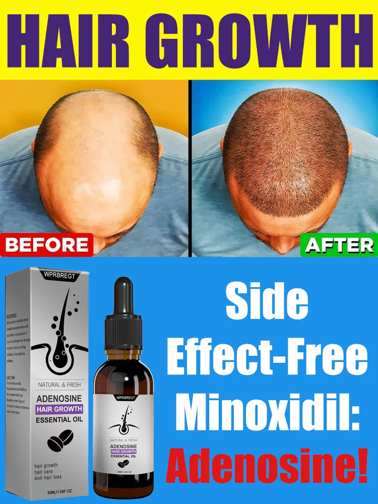 Adenosine Hair Growth Serum Essence Solution Oil Products Activator Fast Baldness Treatment Hereditary Seborrheic Alopecia Loss