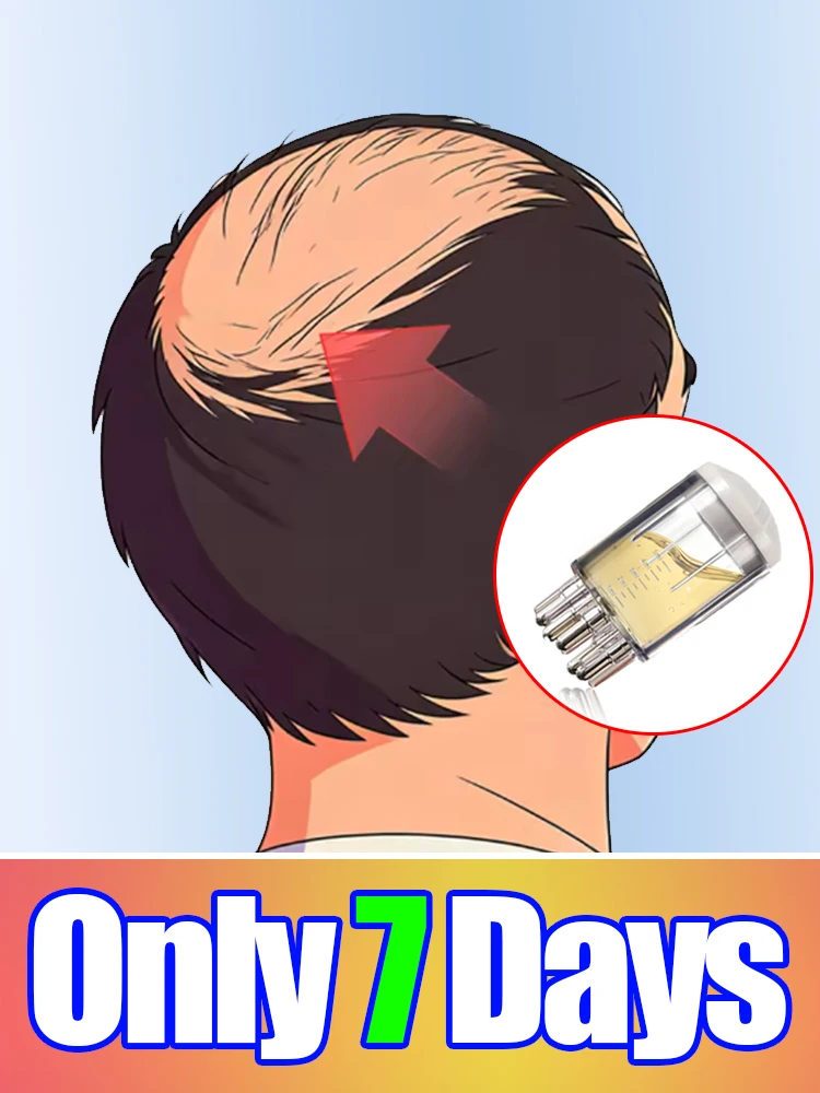 

Средство для пробуждения спящих фолликулов для густоты волос, M-образной формы, для решения проблем с волосами и защиты здоровья кожи головы, инструмент для ухода.