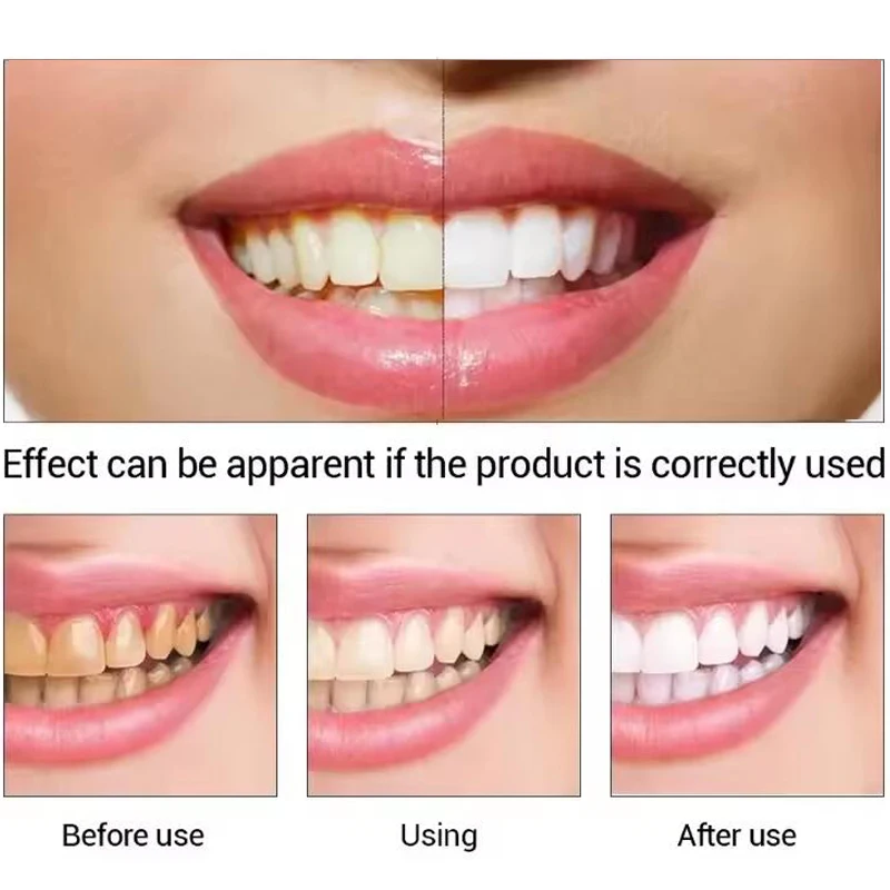 Stylo de blanchiment des dents blanc éblouissant, stylo de blanchiment des dents instantané, éclaircit votre sourire, outils de soins d'hygiène des dents